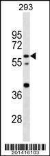 Anti-CNOT4 Antibody
