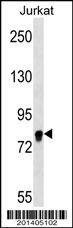 Anti-EIF4B Antibody