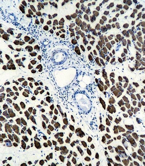 Anti-ACTA1 Antibody