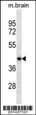 Anti-POU5F1 (Ascites) Antibody
