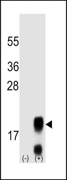 Anti-FSHB/FSH (Center) Antibody