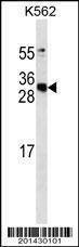 Anti-APCS (Ascites) Antibody