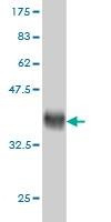 Anti-ALPI Antibody