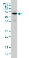 Anti-ALPI Antibody