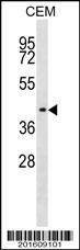 Anti-IHH (C-term) (Ascites) Antibody