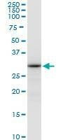Anti-ALYREF Antibody