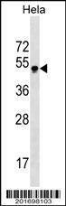 Anti-GBX2 (Center) Antibody