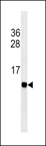 Anti-Mouse Cardiac FABP (Ascites) Antibody