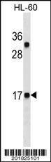Anti-CALCA/CT (Ascites) Antibody