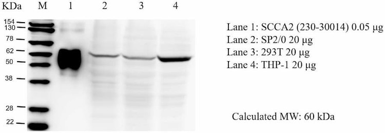 Anti-SCCA2 Antibody, Biotinylated