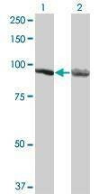 Anti-AMPD2 Antibody