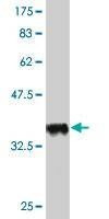 Anti-AMPD2 Antibody