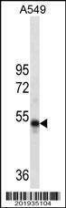 Anti-RUVBL1 Antibody