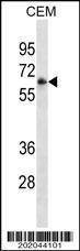 Anti-FCGR3A (Ascites) Antibody