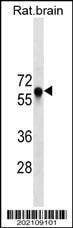 Anti-GAD2 (Ascites) Antibody