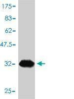 Anti-ANAPC11 Antibody