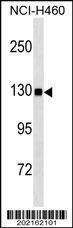 Anti-USP8 (C-term C1072) (Ascites) Antibody