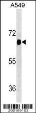 Anti-DYRK2 Antibody