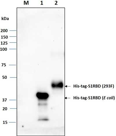 Anti-His-tag Antibody