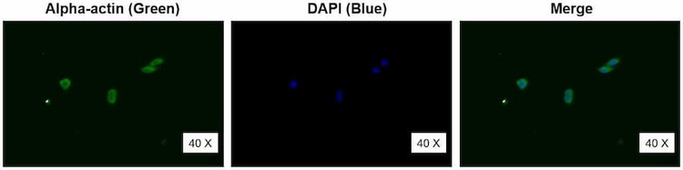 Anti-alpha-Actin (12-30aa) Antibody