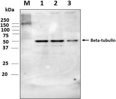 Anti-Beta-tubulin (166-183aa) Antibody