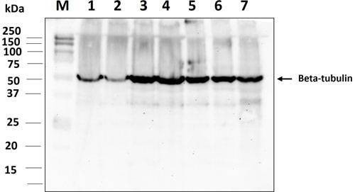 Anti-Beta-tubulin (166-183aa) Antibody