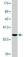 Anti-ANGPTL3 Antibody