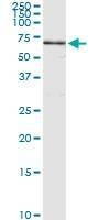Anti-ANGPTL3 Antibody