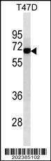 Anti-ALB Antibody