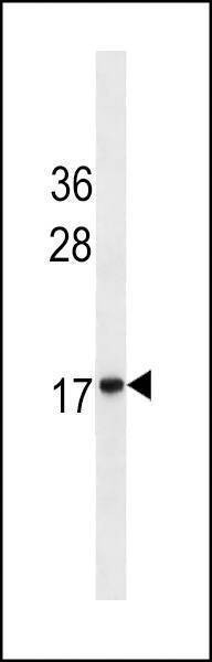 Anti-HMG2 (Ascites) Antibody