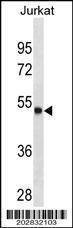 Anti-ARSA (C-term) Antibody