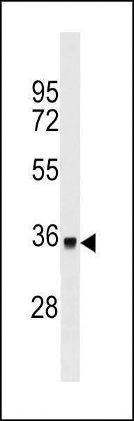 Anti-DYT1 Antibody