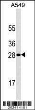 Anti-HPRT1 (Ascites) Antibody