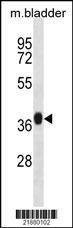 Anti-STRA8 Antibody