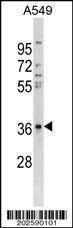Anti-CTGF Antibody