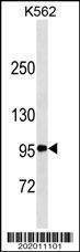 Anti-TNFRSF8/CD30 (Center) (Ascites) Antibody