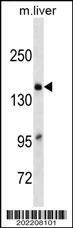 Anti-Mouse A2M (C-term) (Ascites) Antibody
