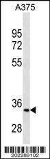 Anti-MC1R (Center) Antibody