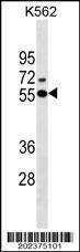 Anti-ESR2 (Center) (Ascites) Antibody