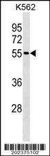 Anti-ESR2 Antibody