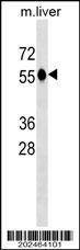 Anti-CAT (Center) (Ascites) Antibody