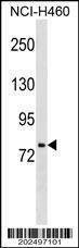 Anti-HNF1A (Ascites) Antibody