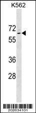 Anti-TP63 (Ascites) Antibody