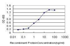 Anti-ANKRD15 Antibody