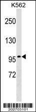 Anti-ITGB2 Antibody