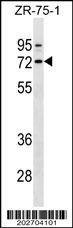 Anti-SELE (Ascites) Antibody