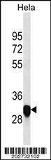 Anti-Rat PIp1 (Center) Antibody