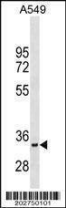 Anti-MyoD1 (N-term) (Ascites) Antibody