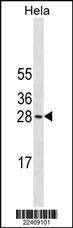 Anti-COMT (N-term) (Ascites) Antibody
