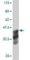 Anti-ANKRD17 Antibody